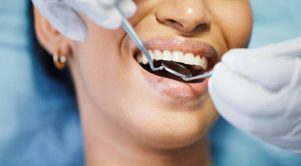 Best Emergency Dental Surgery in Shelbyvle, IL